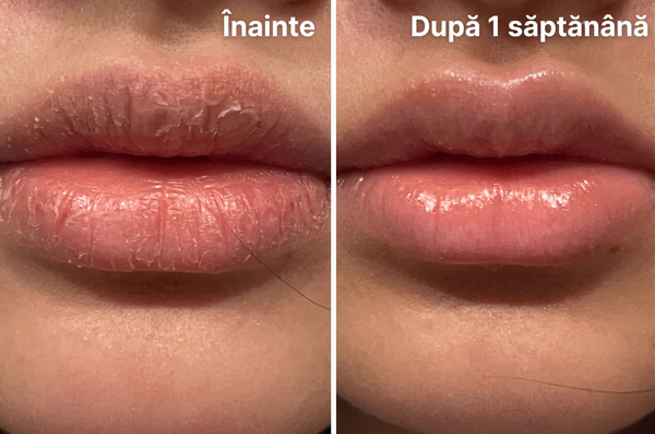Balsam Gloss Hidratant pentru Buze